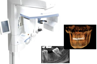 デジタルパノラマ、歯科用CT