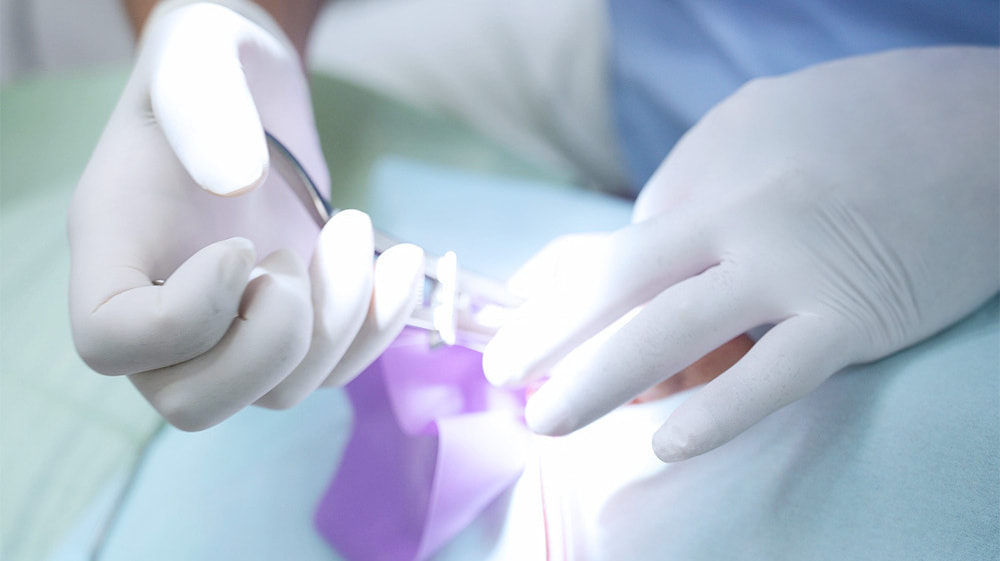 ラバーダム防湿_治療風景