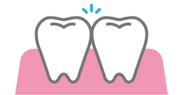 噛み合わせ治療_イメージイラスト